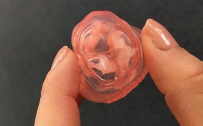 Study Confirms Effectiveness of 3D Modelling and 3D Printing in Prevention of Heart Valve Complications